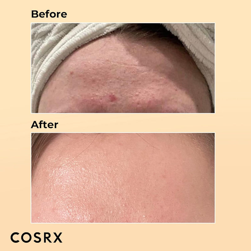 Cosrx Advanced Snail 96 Mucín Leistung Essence Serum 100 ml